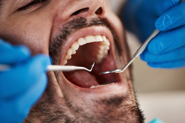 Best Emergency Gum Treatment in Oak Lawn, IL