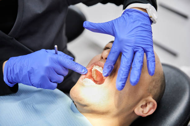 Best Emergency Dental Care for Broken or Chipped Teeth in Oak Lawn, IL
