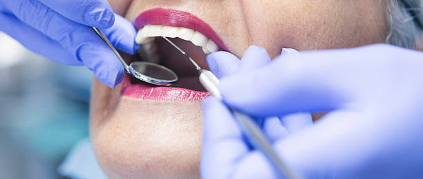 Best Emergency Wisdom Teeth Removal in Oak Lawn, IL